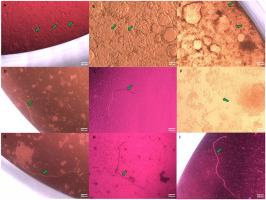 Survival and growth of M. perstans larvae in a human colon carcinoma cell line-based in vitro culture