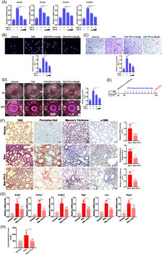 Targeting the chromatin remodelling protein Brahma-related gene 1 for intervention of pulmonary fibrosis