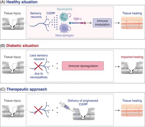 The healing power of sensory neurons: New horizons for diabetic and neuropathic tissue repair