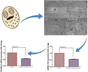 MicroRNA-145 enhances lung cancer cell progression after exposure to lyophilized fertile hydatid cyst fluid of Echinococcus granulosus sensu stricto