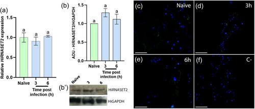 Exploring the role of RNASET2 in the immune response of black soldier fly larvae