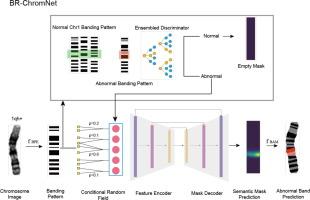 BR-ChromNet: Banding resolution localization of chromosome structural abnormality with conditional random field