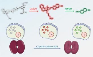 Construction of a sequence activated fluorescence probe for simultaneous detection of γ-glutamyl transpeptidase and peroxynitrite in acute kidney injury