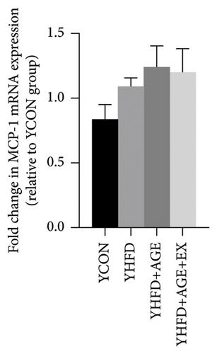 Effects of Voluntary Exercise on Liver and Adipose Tissue Dysfunction in Both Young and Middle-Aged Mice Fed a High-Fat Diet Combined with Dietary Advanced Glycation End Products