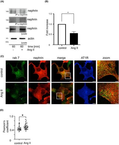 A molecular mechanism for angiotensin II receptor blocker-mediated slit membrane protection: Angiotensin II increases nephrin endocytosis via AT1-receptor-dependent ERK 1/2 activation