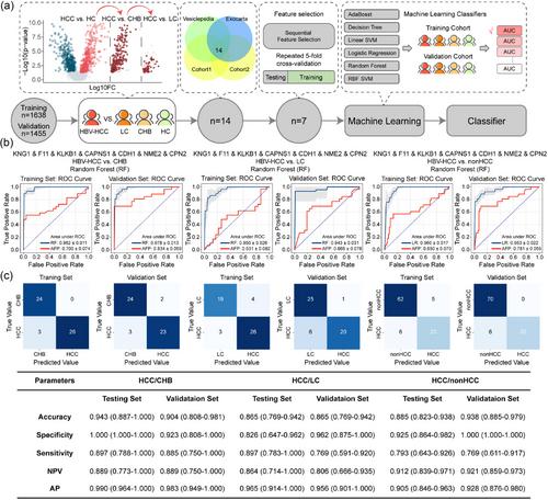 The trajectory of vesicular proteomic signatures from HBV-HCC by chitosan-magnetic bead-based separation and DIA-proteomic analysis