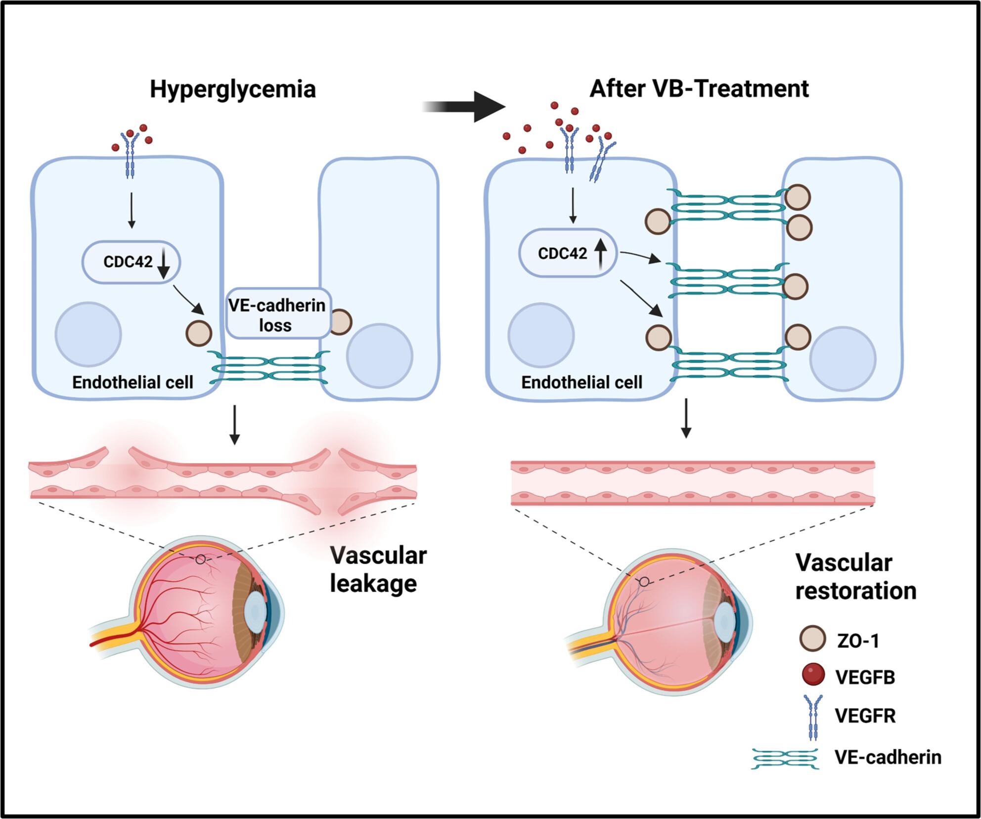 VEGF-B prevents chronic hyperglycemia-induced retinal vascular leakage by regulating the CDC42-ZO1/VE-cadherin pathway