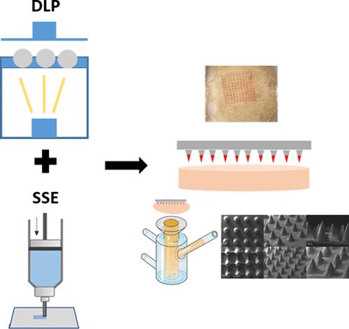 Fabrication of Hybrid Coated Microneedles with Donepezil Utilizing Digital Light Processing and Semisolid Extrusion Printing for the Management of Alzheimer’s Disease