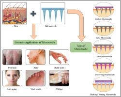 Application of microneedle arrays in cosmetics: Promises, advances, and challenges