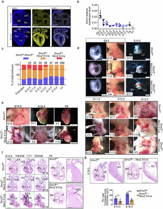 SMC3 contributes to heart development by regulating super-enhancer associated genes