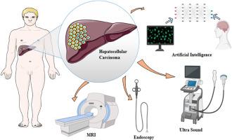 Hepatocellular carcinoma imaging: Exploring traditional techniques and emerging innovations for early intervention