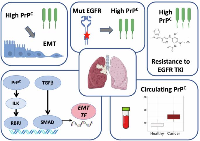 PrPC controls epithelial-to-mesenchymal transition in EGFR-mutated NSCLC: implications for TKI resistance and patient follow-up