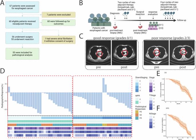 Spatial proteomic profiling elucidates immune determinants of neoadjuvant chemo-immunotherapy in esophageal squamous cell carcinoma