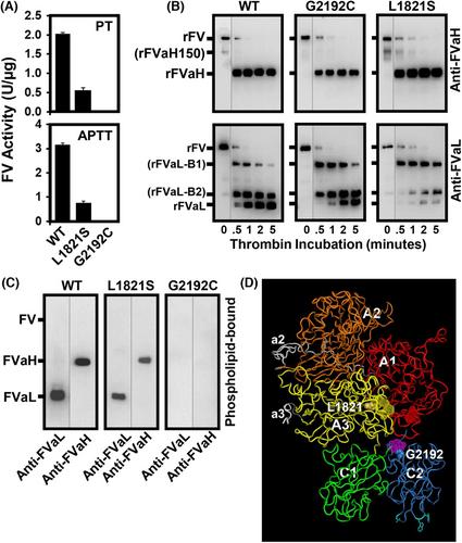 Factor V haemostatic diathesis impairing thrombin activation, membrane binding and circulating antigen level due to a novel compound heterozygous mutation, Leu1821Ser and Gly2192Cys