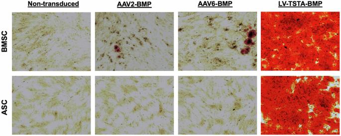 Correction: Limited potential of AAV-mediated gene therapy in transducing human mesenchymal stem cells for bone repair applications