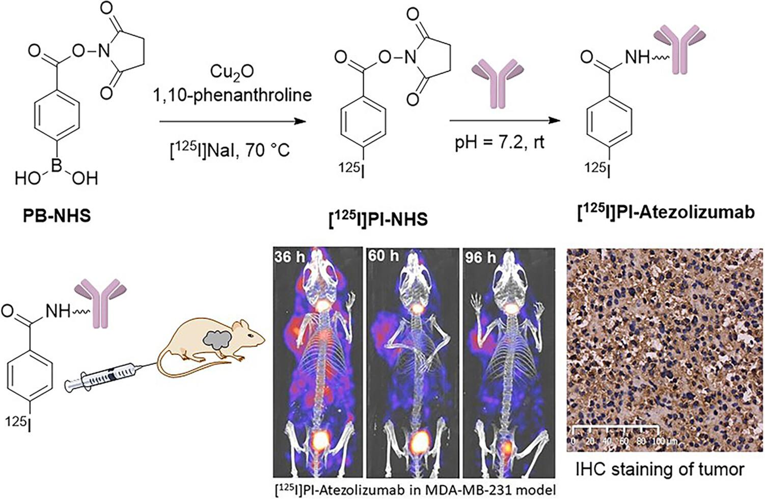 Preliminary Research of Radiolabeled Atezolizumab for the Noninvasive Evaluation of TNBC PD-L1 Expression In Vivo