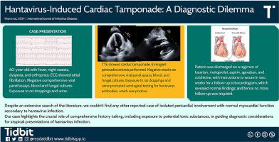 Hantavirus-induced cardiac tamponade: A diagnostic dilemma