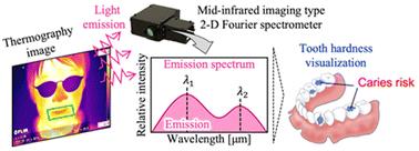 Mid-infrared passive spectroscopic imaging for visualizing tooth quality