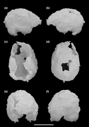 The DNH 7 endocast of Paranthropus robustus from Drimolen, South Africa: Reconsidering the functional significance of an enlarged occipital-marginal (O/M) sinus system in robust australopithecines