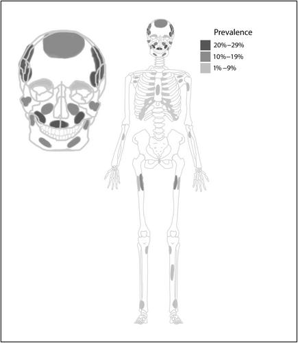 High prevalence of adult and nonadult scurvy in an early agricultural transition site from Mainland Southeast Asia was associated with decreased survivorship