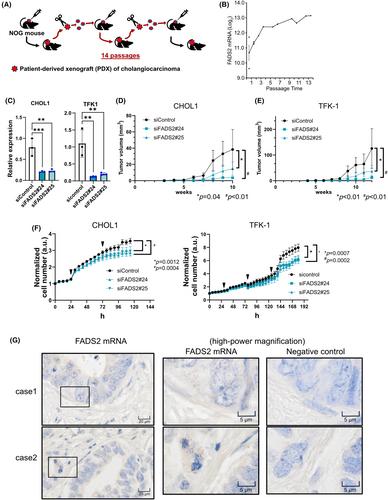 Delta-6 desaturase FADS2 is a tumor-promoting factor in cholangiocarcinoma