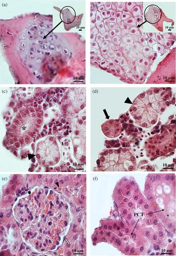 Hyaluronic acid-alginate hydrogel stimulates the differentiation of neonatal mouse testicular cells into hepatocyte-like and other cell lineages in three-dimensional culture