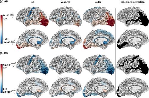 Cortical microstructure and hemispheric specialization—A diffusion-imaging analysis in younger and older adults