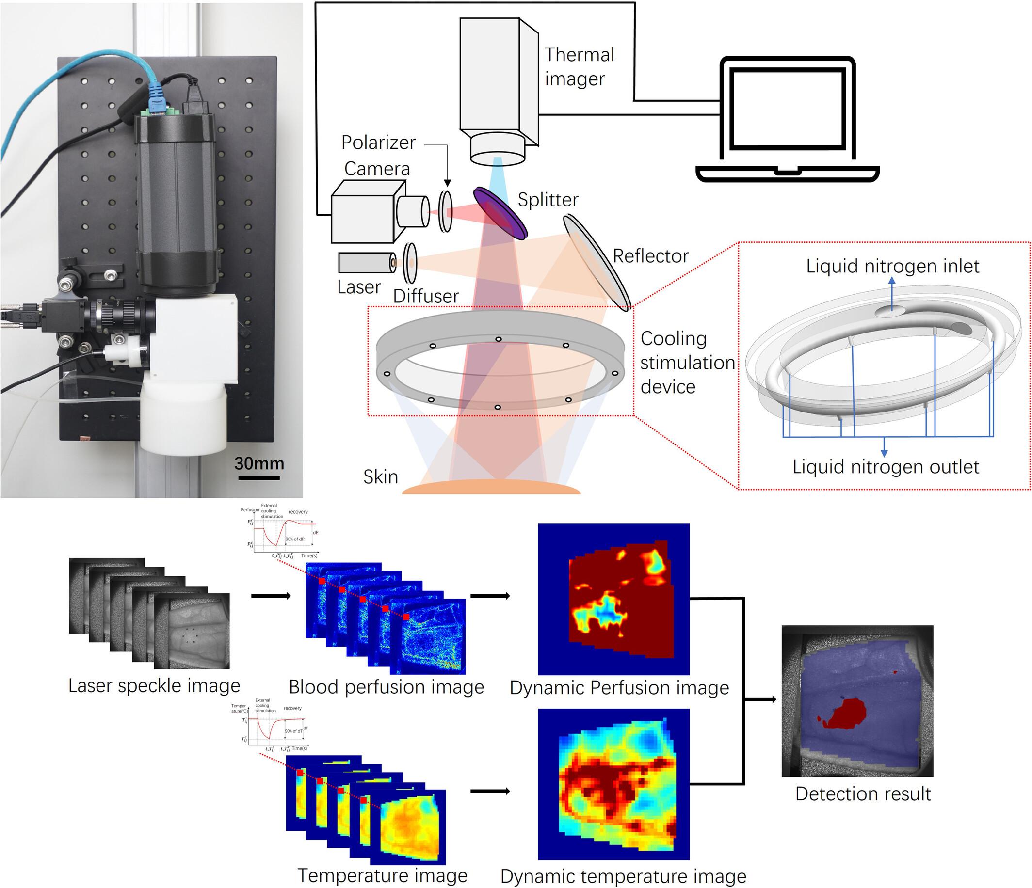 Dual-Modal Optical Imaging of Tissue Perfusion in Response to Cooling Stimulation Facilitates Early Detection of Pressure Ulcer