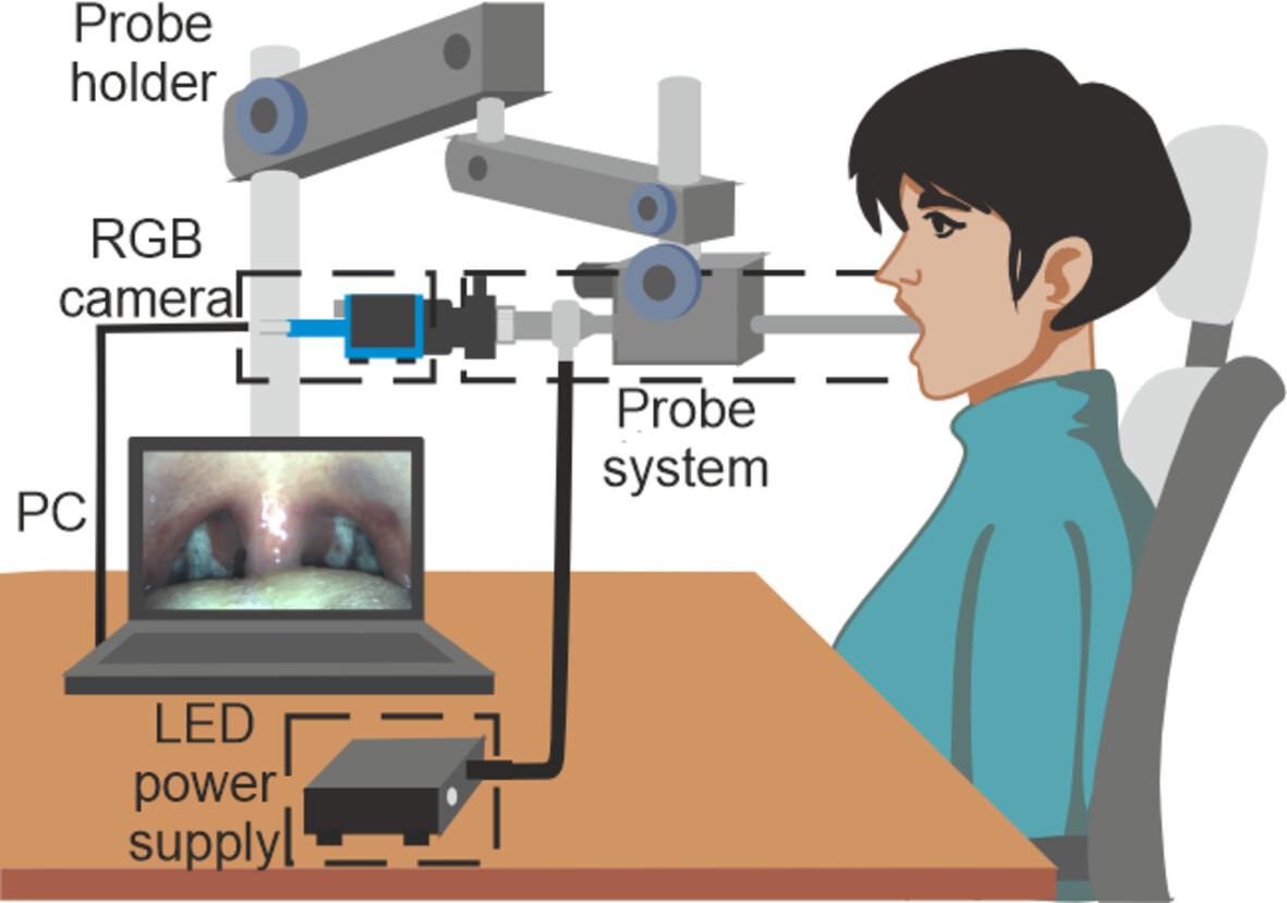 Post-Surgical Non-Invasive Wound Healing Monitoring in Oropharyngeal Mucosa