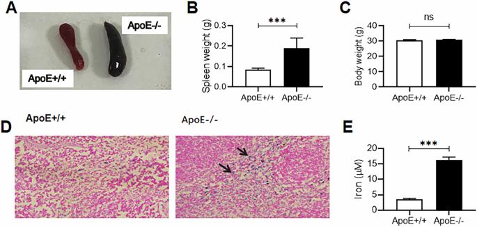 Apolipoprotein E deficiency leads to the polarization of splenic macrophages towards M1 phenotype by increasing iron content