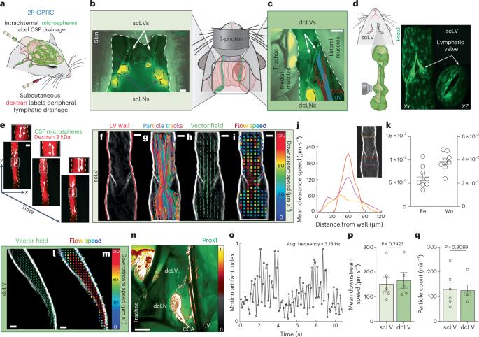 Restoration of cervical lymphatic vessel function in aging rescues cerebrospinal fluid drainage