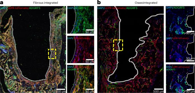 The formation and maintenance of peri-implant fibrosis requires skeletal cells expressing the leptin receptor