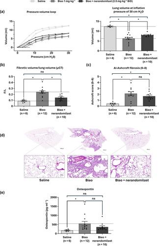 PDE4B inhibition by nerandomilast: Effects on lung fibrosis and transcriptome in fibrotic rats and on biomarkers in human lung epithelial cells