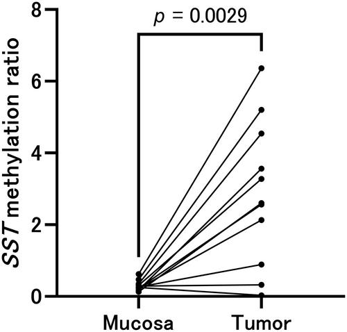 A novel index combining fecal immunochemical test, DNA test, and age improves detection of advanced colorectal adenoma