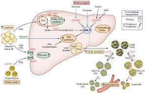 Lipid metabolism in MASLD and MASH: From mechanism to the clinic