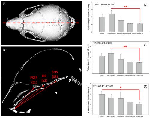 In utero nicotine exposure affects murine palate development