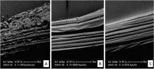 High Xylanase and Low Cellulase Producing Bacteria as a Whole Cell Biocatalyst for Eco-Friendly Surface Modification of Banana Pseudostem Fibers