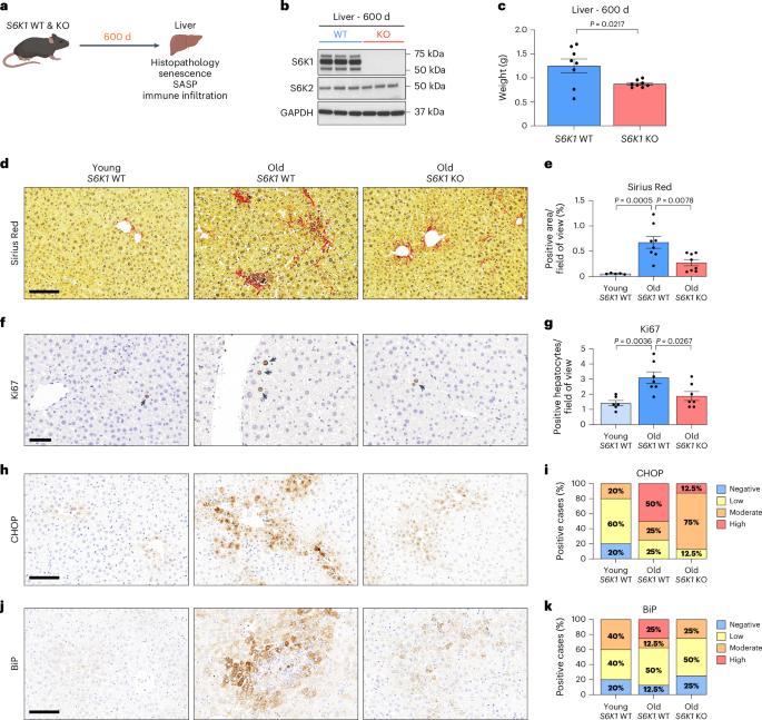 Ribosomal S6 kinase 1 regulates inflammaging via the senescence secretome