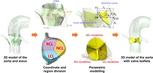 Fluid–structure interaction analysis of a healthy aortic valve and its surrounding haemodynamics