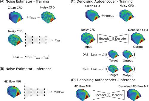 A comparison of machine learning methods for recovering noisy and missing 4D flow MRI data