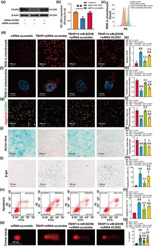 β-Hydroxybutyrate enhances chondrocyte mitophagy and reduces cartilage degeneration in osteoarthritis via the HCAR2/AMPK/PINK1/Parkin pathway