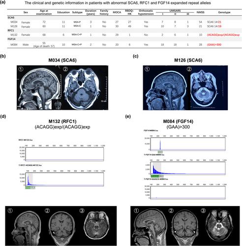 摘要图片