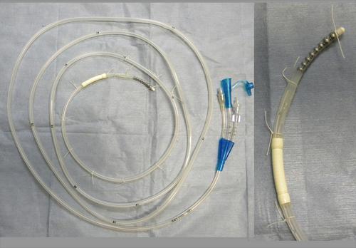 Endoscopic insertion of an ileus tube with attached silk threads as endoscope grasping points