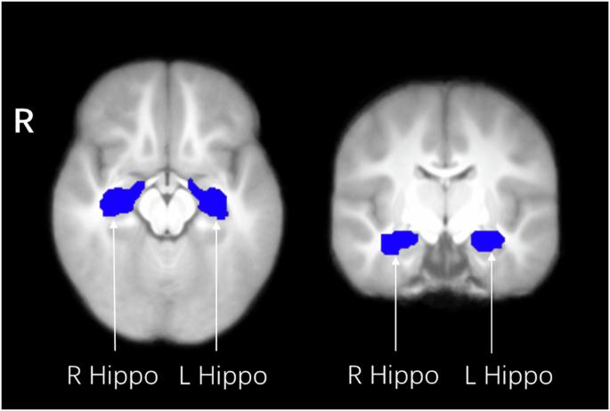 Exposure to gestational diabetes mellitus in utero impacts hippocampal functional connectivity in response to food cues in children