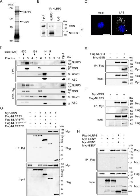 Gelsolin alleviates rheumatoid arthritis by negatively regulating NLRP3 inflammasome activation