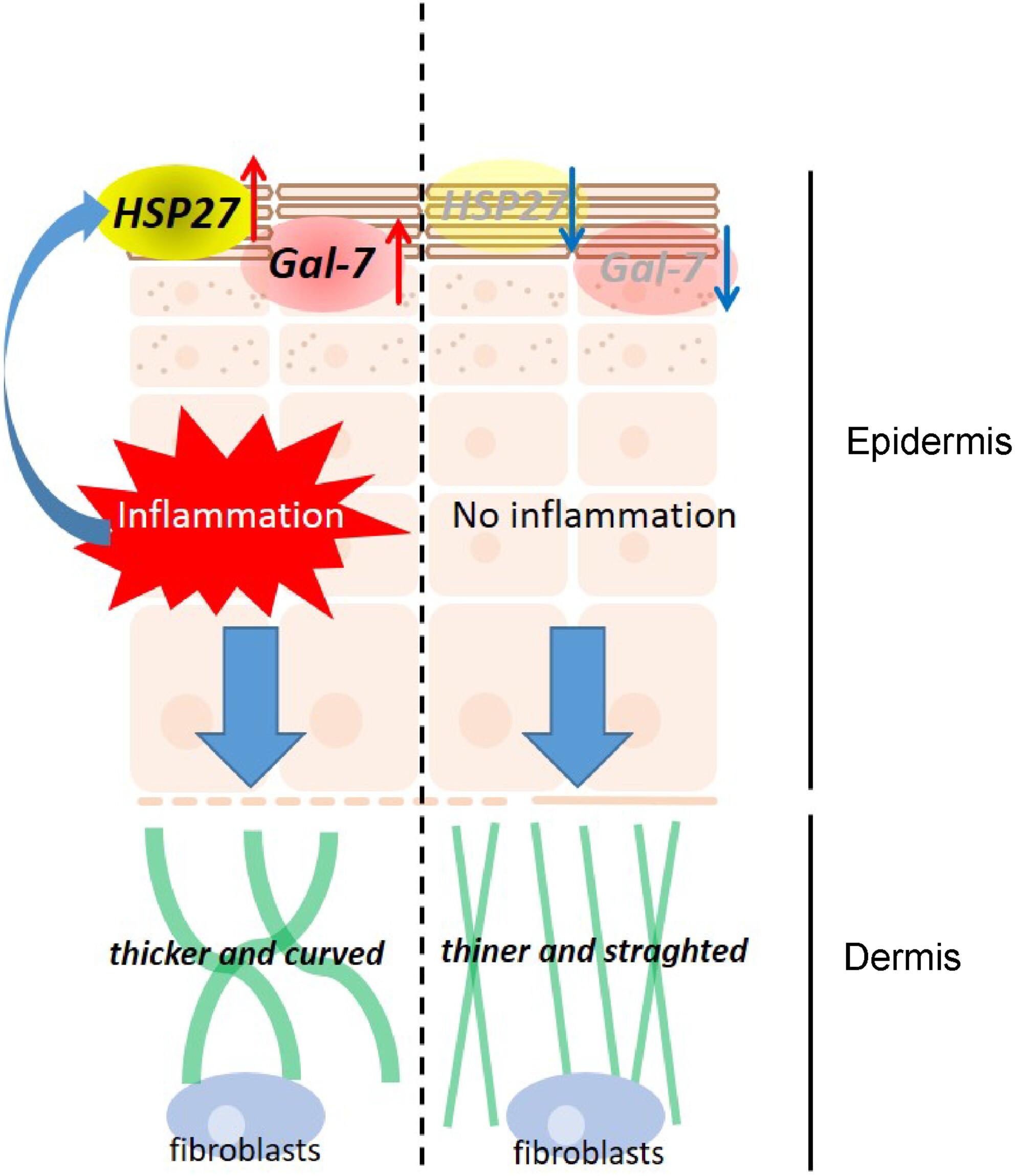 The effect of degeneration of elastic fibres on loss of elasticity and wrinkle formation