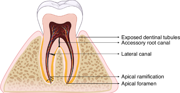 Expert consensus on the diagnosis and therapy of endo-periodontal lesions