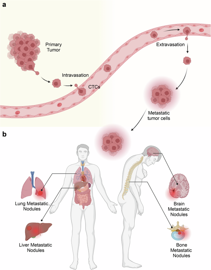 Circulating tumor cells: from new biological insights to clinical practice.