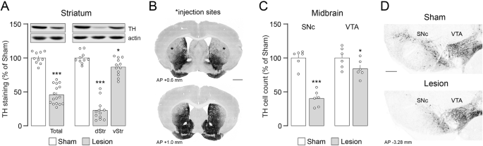 Rewarding properties of L-Dopa in experimental parkinsonism are mediated by sensitized dopamine D1 receptors in the dorsal striatum.