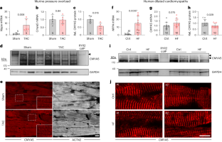 Virally delivered CMYA5 enhances the assembly of cardiac dyads